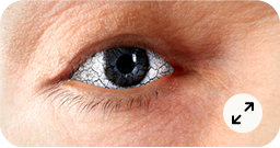 Diplopia-1