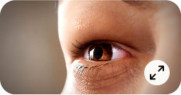 Photophobia